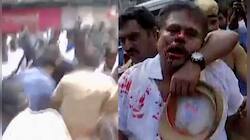 சசிகலா புஷ்பா வக்கீல் ரத்தம் சொட்ட சொட்ட காயம்!!