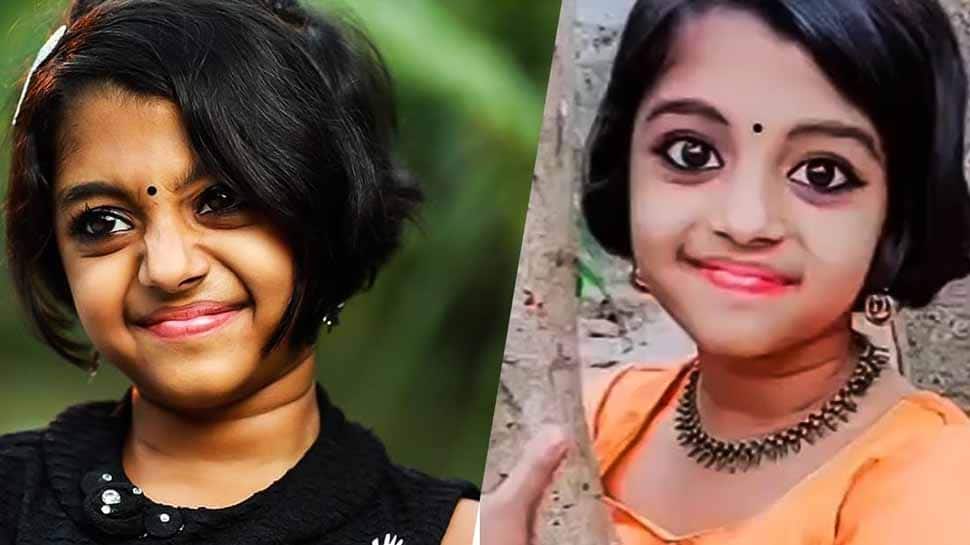 9 வயது TikTok பிரபலம் ஆருணி குருப் மூளை காய்சலால் மரணம்!! 9 வயது TikTok பிரபலம் ஆருணி குருப் மூளை காய்சலால் மரணம்!!