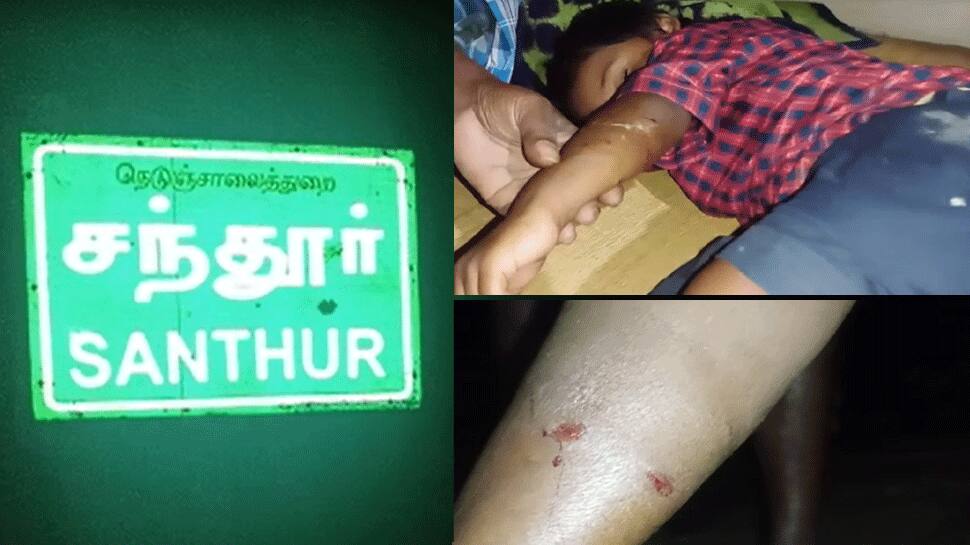 சந்தூர் கிராமத்தில் குழந்தைகள் உட்பட 80-க்கும் மேற்பட்டோரை கடித்து குதறிய வெய்நாய்! சந்தூர் கிராமத்தில் குழந்தைகள் உட்பட 80-க்கும் மேற்பட்டோரை கடித்து குதறிய வெய்நாய்!