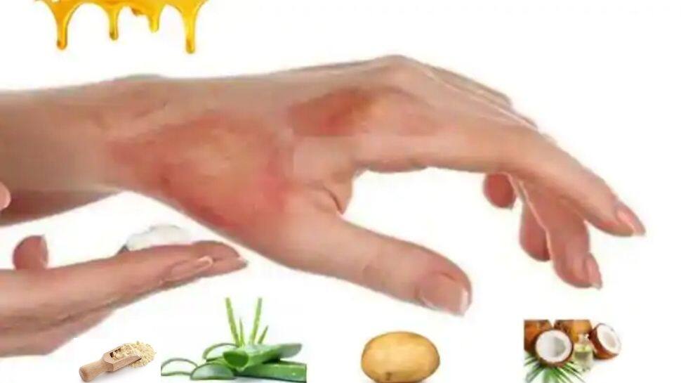 Photo Gallery Do you know about these effective home remedies for