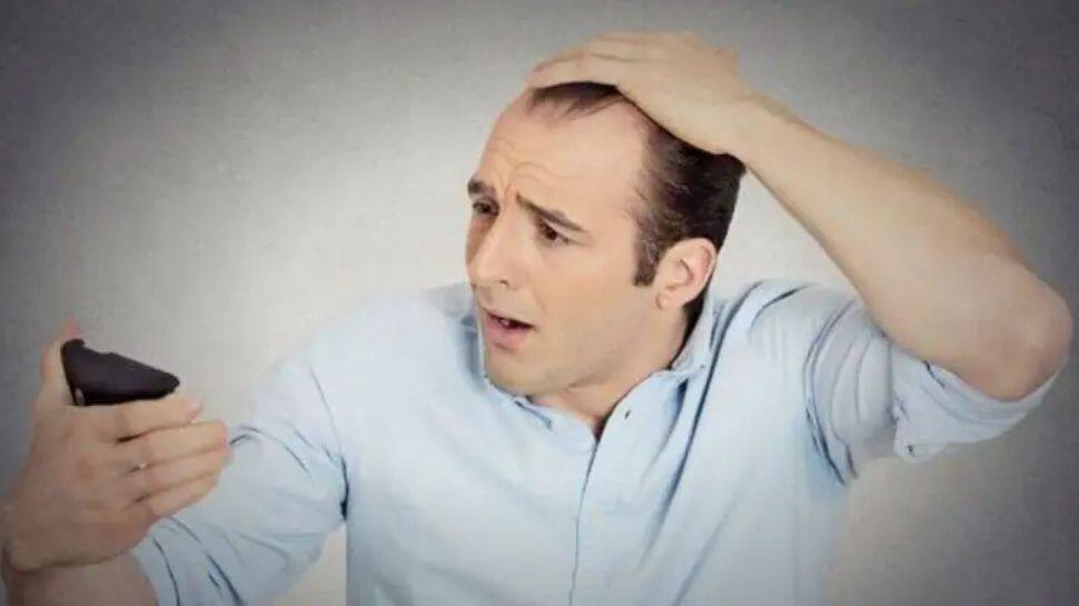 Hair Fall Treatment: Tips to Help Save Your Hair | Hair Fall Treatment:  வழுக்கை தலையாவதை தடுக்க இத ஃபாலோ பண்ணுங்க | Health News in Tamil