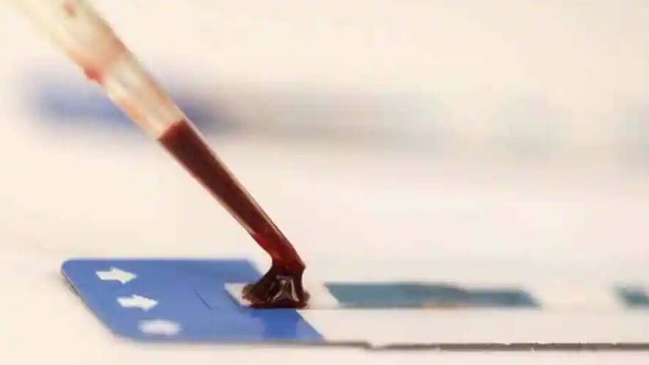 Medical Marvel: A single blood test to detect 50 types of cancer before ...