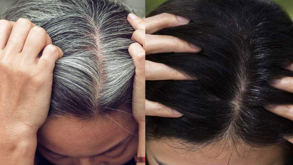 Fed up of your grey hair Fish can be a cure for your problem Know how   Beauty News  India TV