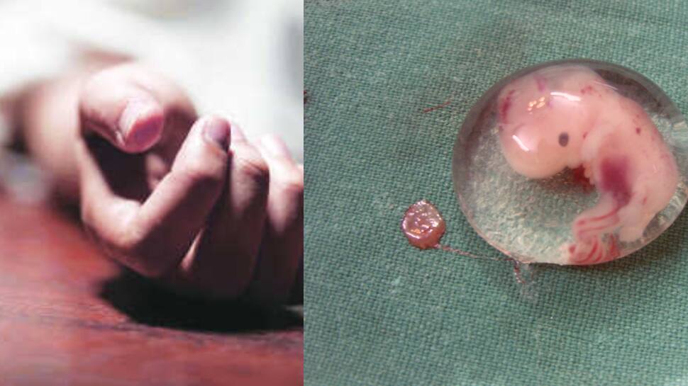 'வயிறு ரணமா வலிக்குது' - கருமுட்டை விவகாரத்தில் பாதிக்கப்பட்ட சிறுமி தற்கொலை முயற்சி!