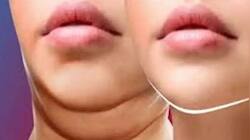 Double Chin பிரச்சனையா? எளிய வீட்டு வைத்தியங்கள் இதோ