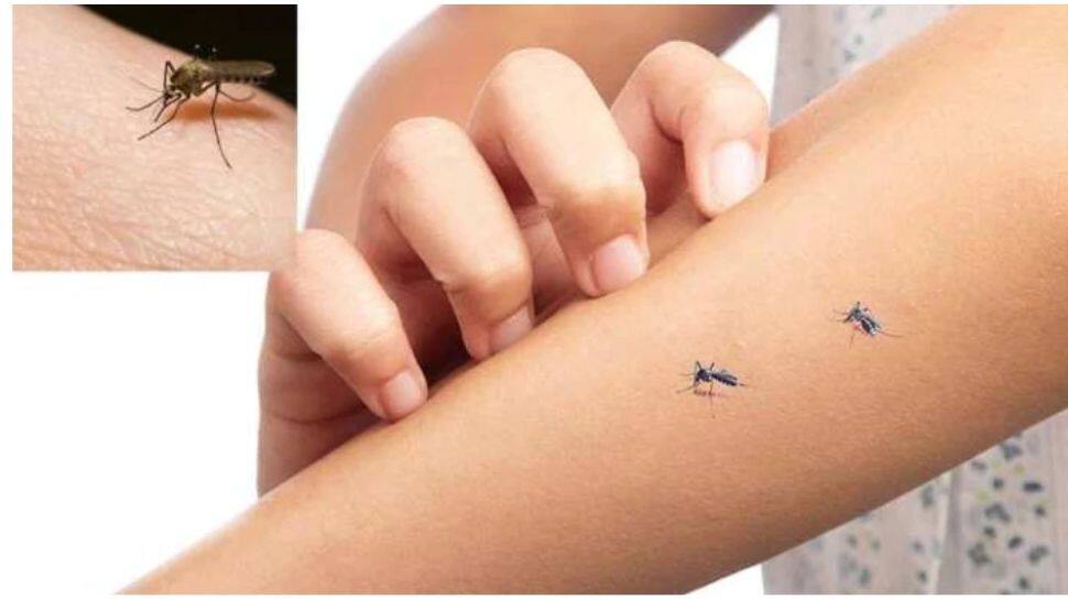 கொசுக்கடியில் இருந்து பாதுகாத்துக் கொள்ளுங்கள்! இதோ வழிமுறை