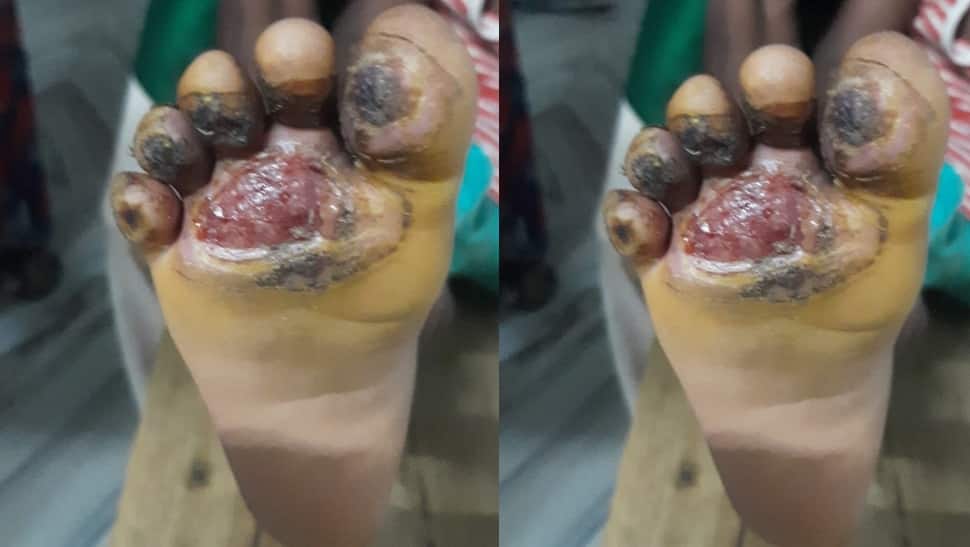 காதலனுடன் சேர்ந்து நான்கு வயது குழந்தையின் காலை அடுப்பில் வைத்த தாய்! 