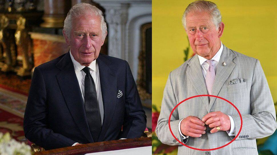 மன்னர் சார்லஸின் வீங்கிய விரல்கள்... மருத்துவர்கள் கூறுவது என்ன..!!