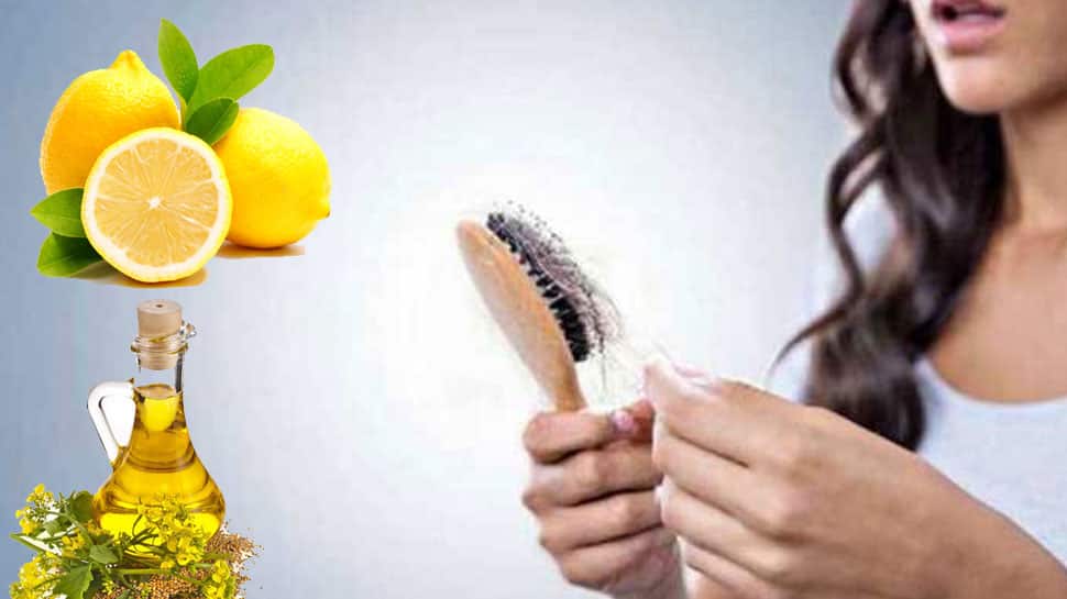 Dandruff is removed by applying lemon juice and mustard oil பொடுகு