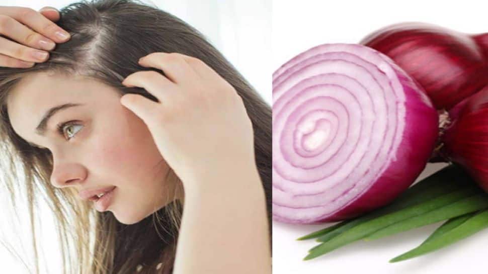 Onion juice will turn white hair black | நரை முடி கருமையாக வளர வெங்காய சாறு  | Health News in Tamil