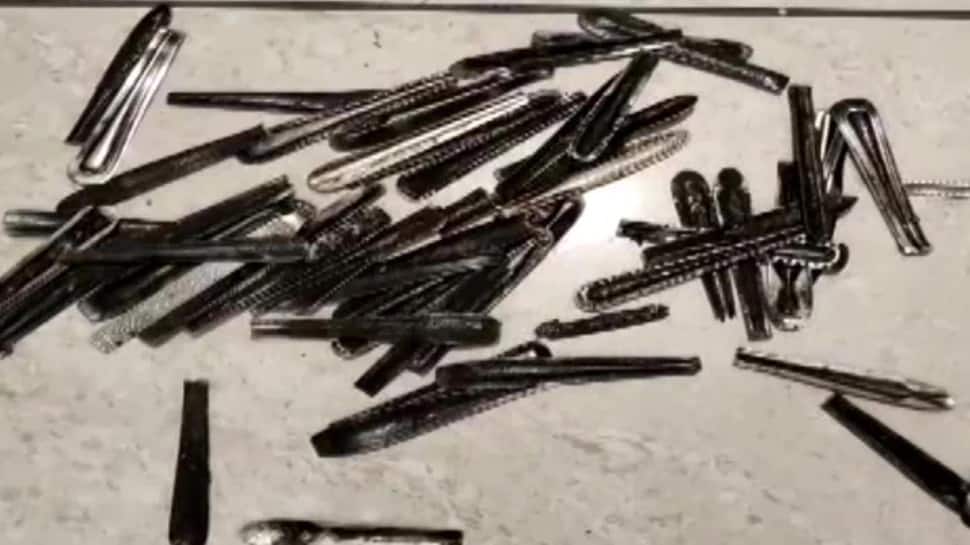 63 ஸ்பூனா...! வயிறா இல்லை வேற எதாவதா - அதிர்ந்த டாக்டர்கள்