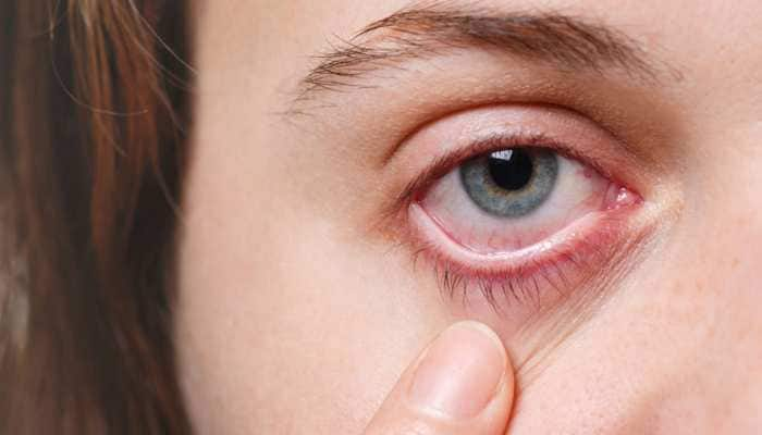 avoid-these-foods-if-you-love-your-eyes-avoid-these-if-you-want-to-do