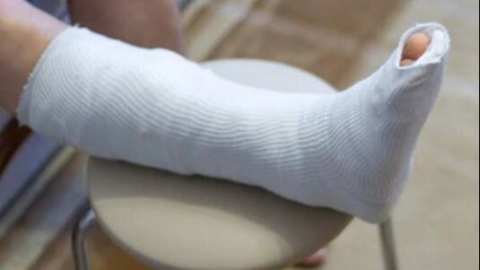 பிரபல கிரிக்கெட் வீரருக்கு காலில் எலும்பு முறிவு! இனி விளையாடுவது சந்தேகம்?