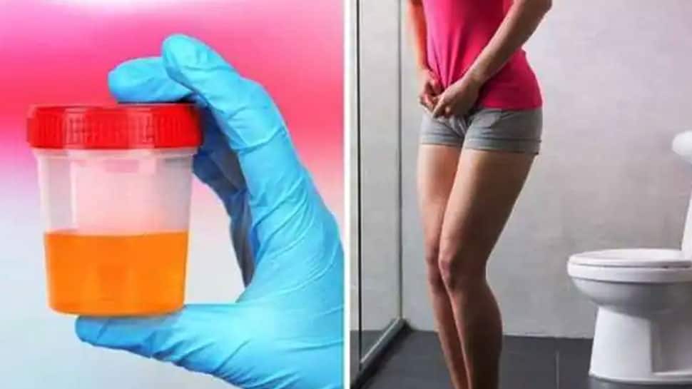 Urine Odor Disease சிறுநீர் கழித்த பின் அதிக துர்நாற்றம் வீசுகிறதா