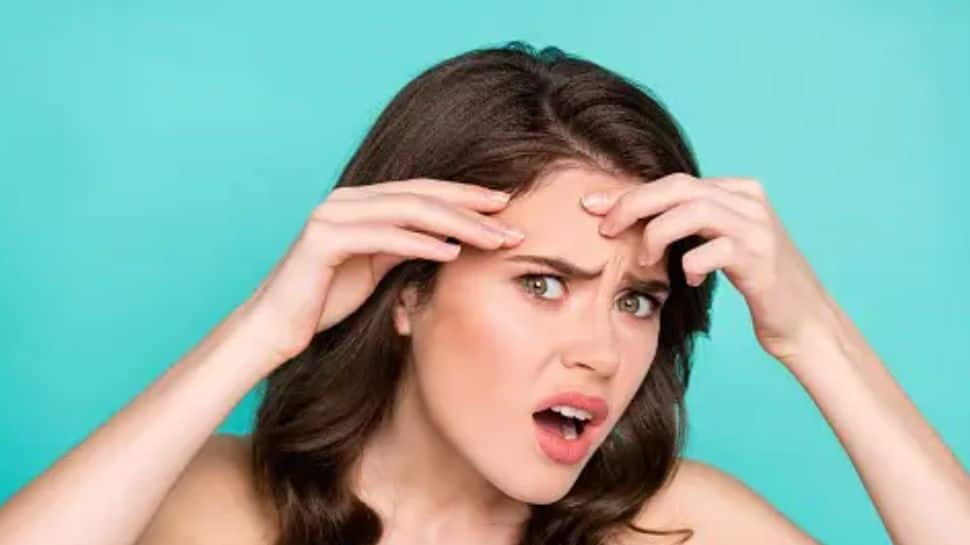 முகத்தில் இருக்கும் துளைகளை விரைவில் சரிசெய்வது எப்படி? சிம்பிள் டிப்ஸ் இதோ..!