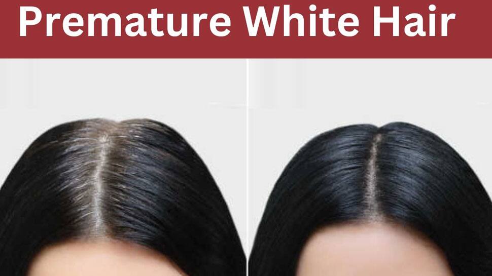 White Hair Problem Solution வெள்ளை முடி, நரைமுடியை தடுக்க.. இந்த