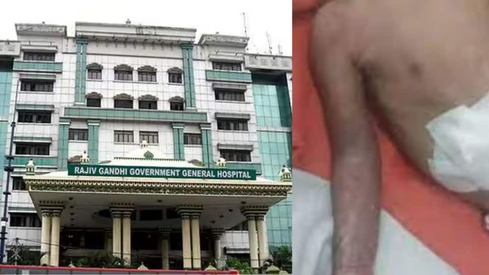 கடந்த மாதம் கை அகற்றப்பட்ட குழந்தை... சிகிச்சை பலனின்றி உயிரிழந்தது