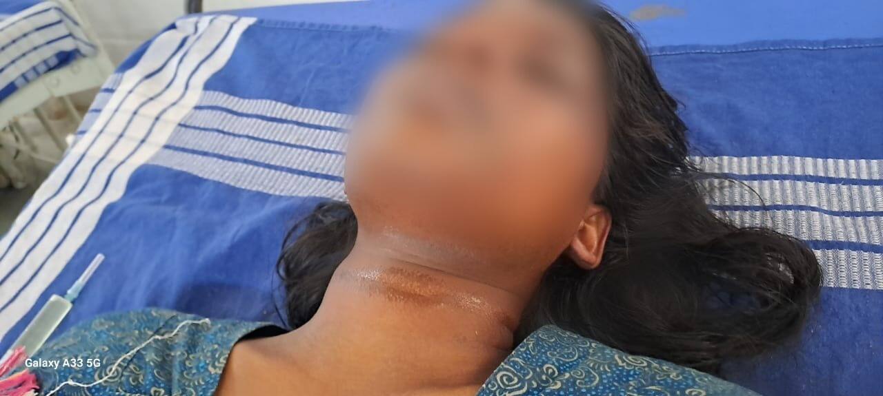 கல்லூரி மாணவியை கொல்ல முயன்ற வாலிபர்! திருமணத்திற்கு மறுத்ததால் வெறி செயல்! 