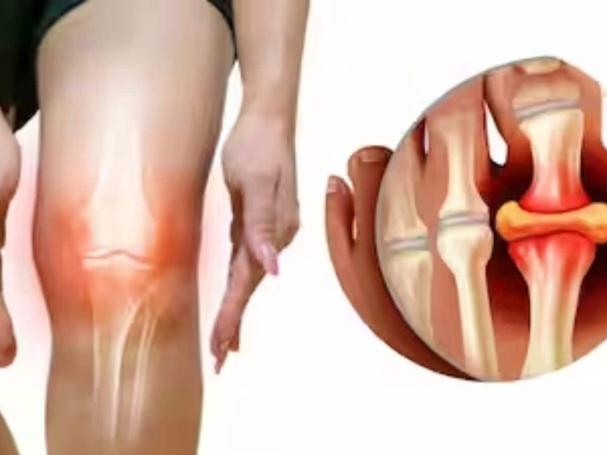 யூரிக் அமில அதிகரிப்பை தெரிந்து கொள்ள சுலப வழி! நோய் அறிகுறிகளைக் காட்டும் கால்