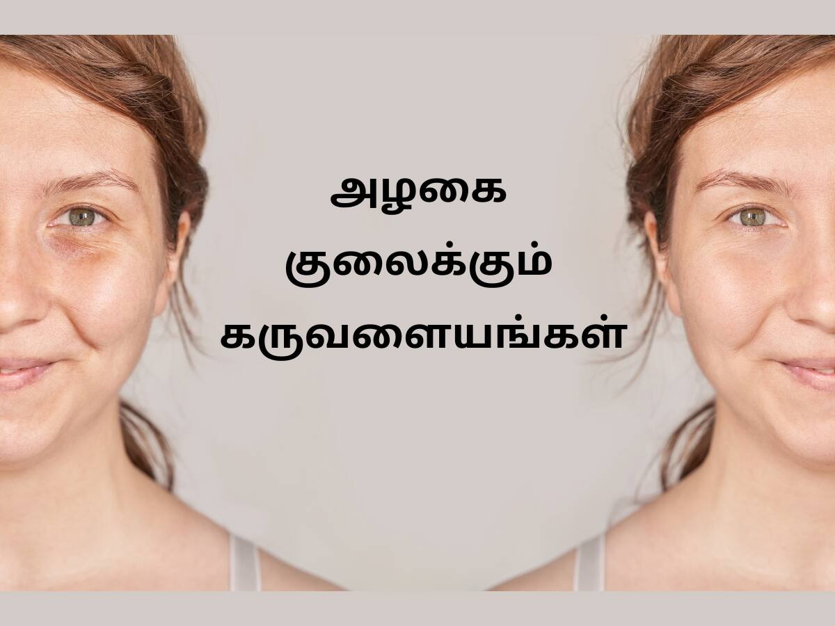 கண்களுக்குக் கீழே கருவளையத்தை ஏற்படுத்தும் ‘5’ வைட்டமின் குறைபாடுகள்!