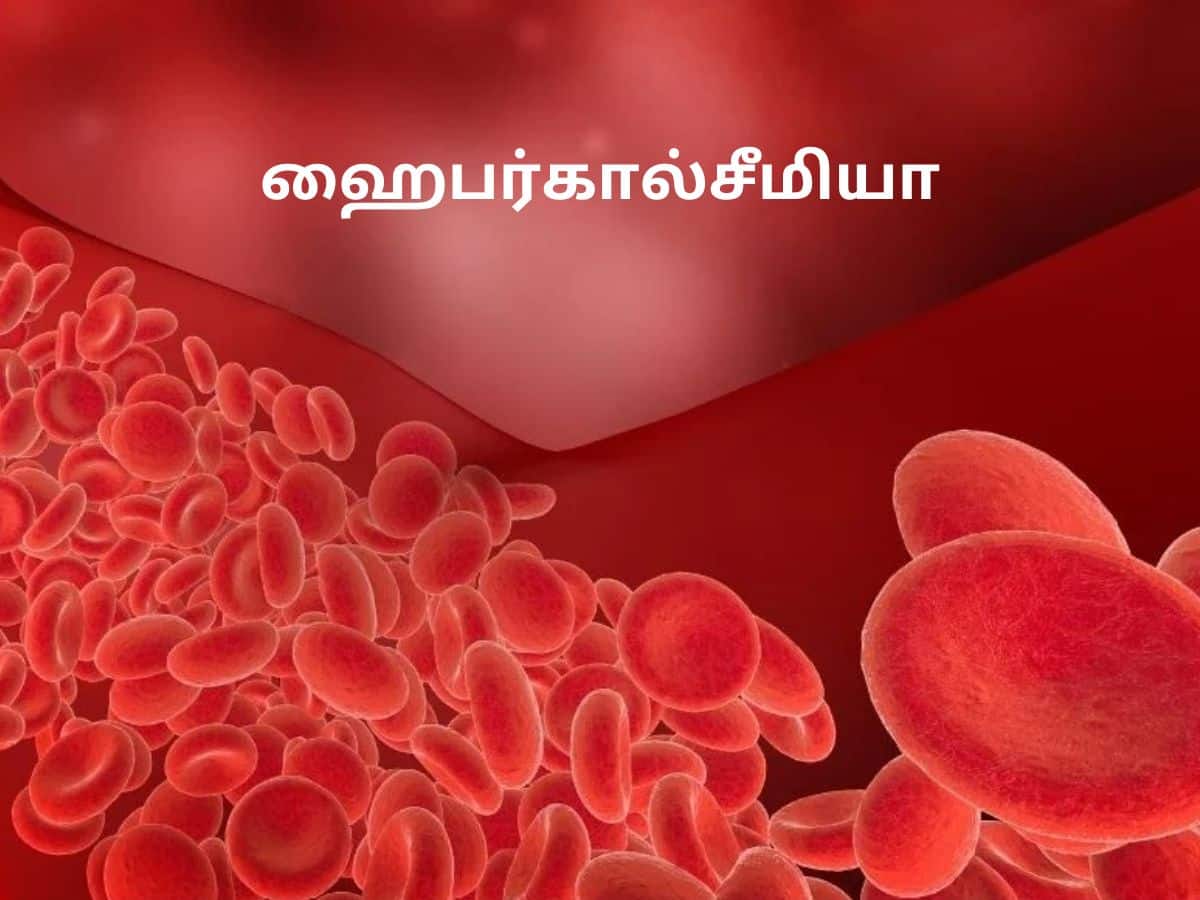 எலும்பு முறிவுக்கு காரணமாகும் ஹைபர்கால்சீமியா! இந்த அறிகுறிகள் இருந்தால் எச்சரிக்கை