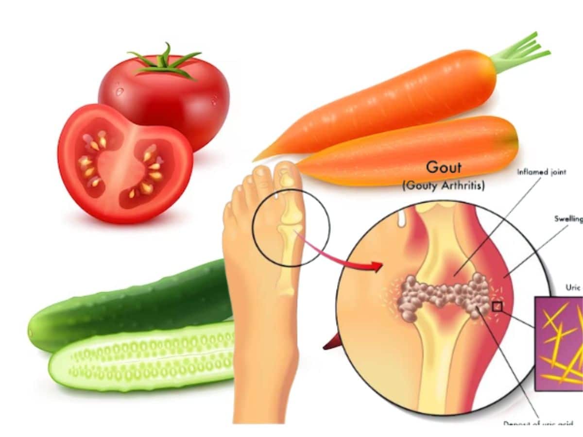 Potato And Senai KizhanguTo Control Uric Acid, Purine உடலில் ப்யூரின்