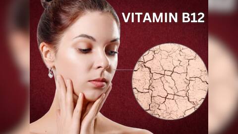 Vitamin B12 deficiency Symptoms and Side Effects | முகத்தில் இந்த அறிகுறிகள் இருக்கா? வைட்டமின் பி12 குறைபாடாக இருக்கலாம்...ஜாக்கிரதை!!
