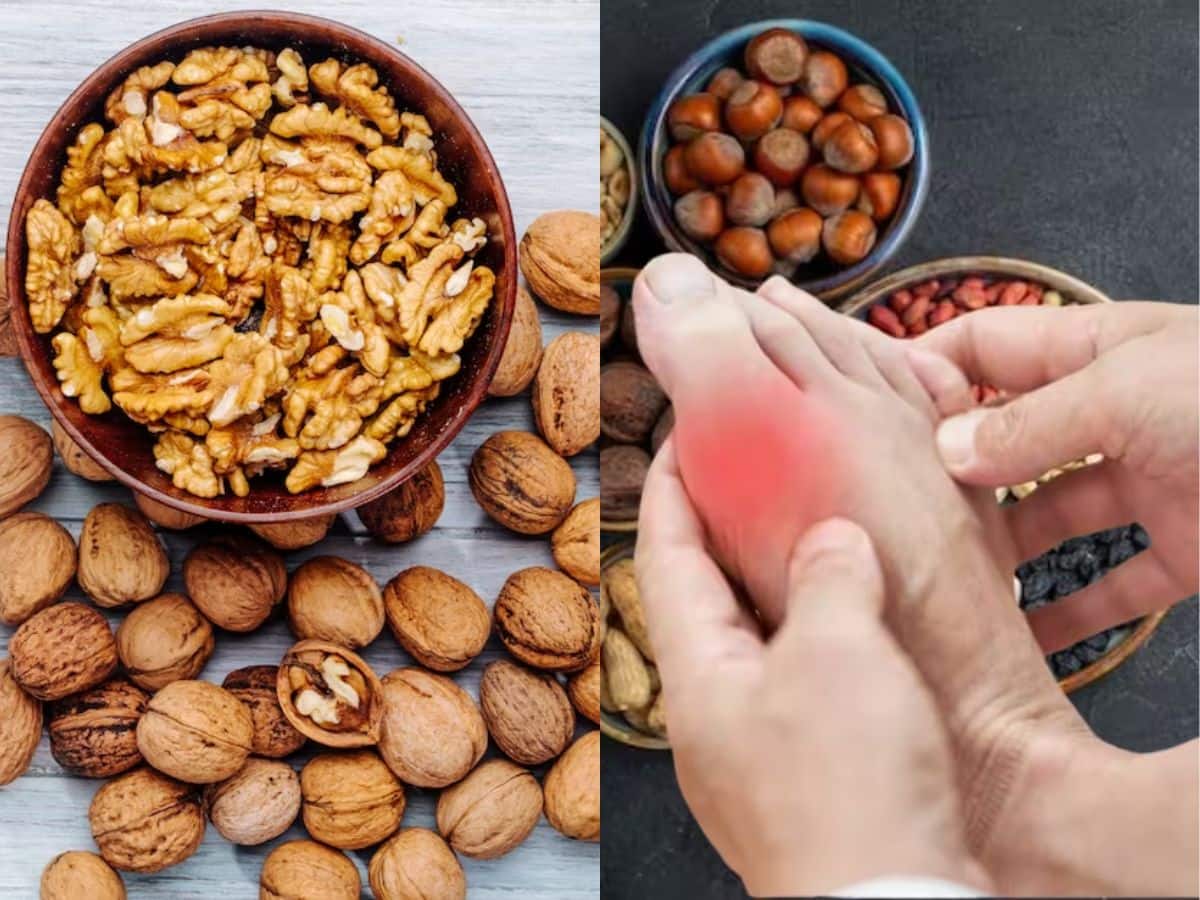 Walnuts For Uric Acid And Brain Booster யூரிக் அமில பிரச்சனையை