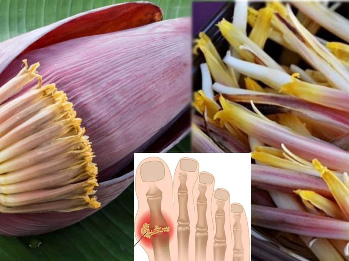 Uric Acid Remedies With Banana Flower Banana Flower வாழைப்பூவின்