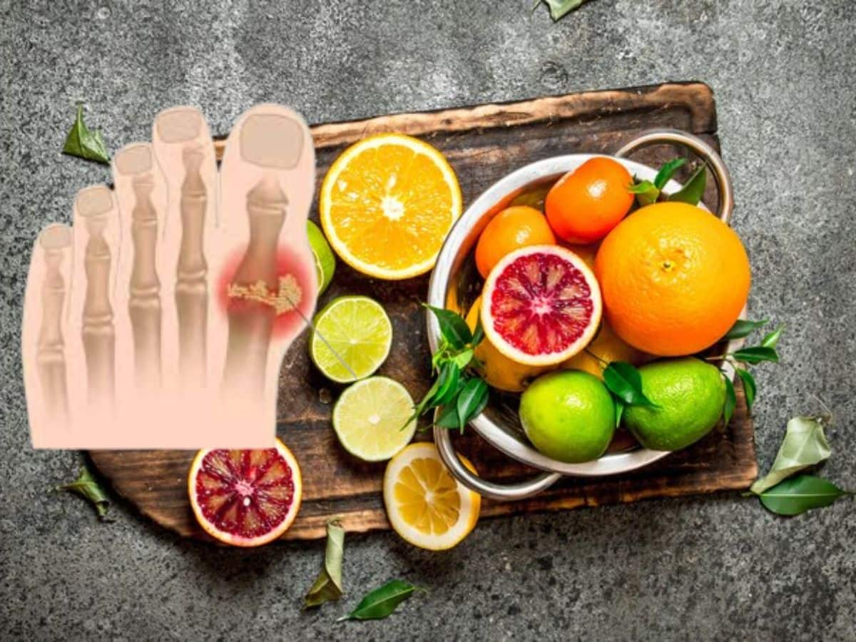 Citrus Fruits In Uric acid Control Sour Will Manage Pulmonary Problem