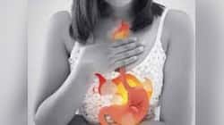Acidity Problem: வாயுத்தொல்லையா? இந்த உணவுகள் பக்கமே போகாதீங்க!!