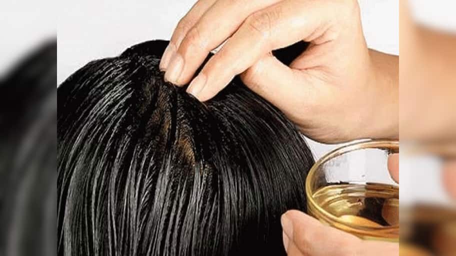 முடி உதிர்ந்து, வழுக்கைக்கு குட் பை சொல்லுங்க.. உடனே இதை செய்யுங்க