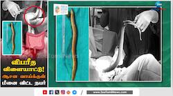 ஆசனவாயில் இருந்து உயிருடன் மீனை விட்ட நபர்! ஷாக்கான மருத்துவர்கள்!