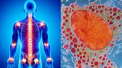 Anti-inflammatory Foods: உடல் அழற்சியை இயற்கையாக குறைத்து... வலியை போக்கும் சூப்பர் உணவுகள்