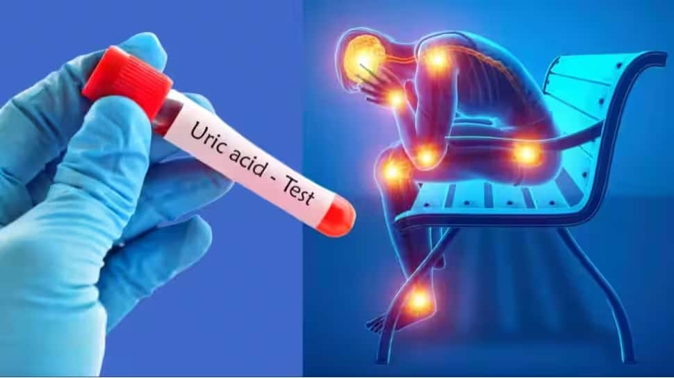 யூரிக் அமில பிரச்சனை இருக்கா... நீங்கள் சாப்பிடக்கூடாத சில உணவுகள் யூரிக் அமில பிரச்சனை இருக்கா... நீங்கள் சாப்பிடக்கூடாத சில உணவுகள்