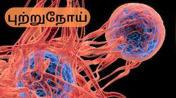 புற்றுநோய் வராமல் இருக்க தினமும் நடங்க... டாக்டர் கூறும் அட்வைஸ்