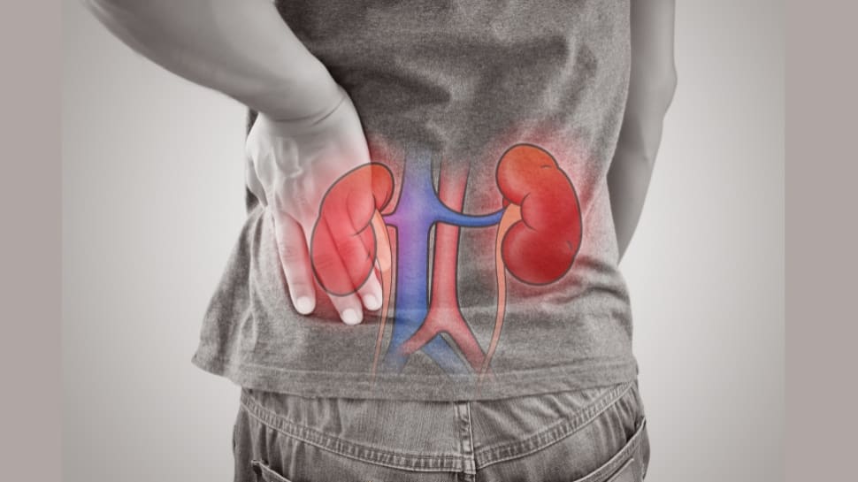 Health Alert! சிறுநீரகம் சிக்கலில் சிக்கி.... செயலிழப்பதற்கான 5 முக்கிய காரணங்கள்
