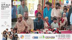 அரசியலில் யாருக்கு ஆதரவு? உதயநிதிக்கா? விஜய்க்கா?- சூரி சொன்ன நச் பதில் 