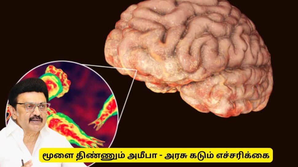 மூளையை திண்ணும் அமீபா - தமிழ்நாடு அரசின் மிகப்பெரிய எச்சரிக்கை
