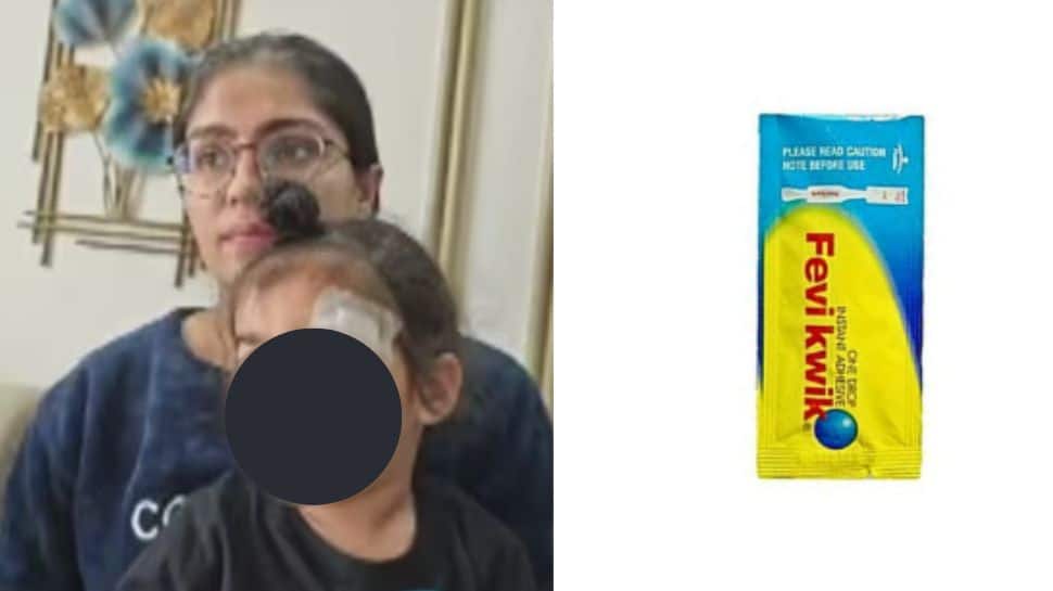 குழந்தைக்கு தலையில் வெட்டு..Gum போட்டு ஒட்டிய மருத்துவர்! அப்பறம் என்ன ஆச்சு?