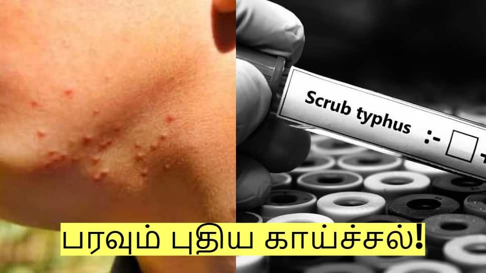 ஜாக்கிரதை! உங்கள் வீட்டில் வயதானவர்கள் இருக்கிறார்களா? பரவும் புதிய காய்ச்சல்!