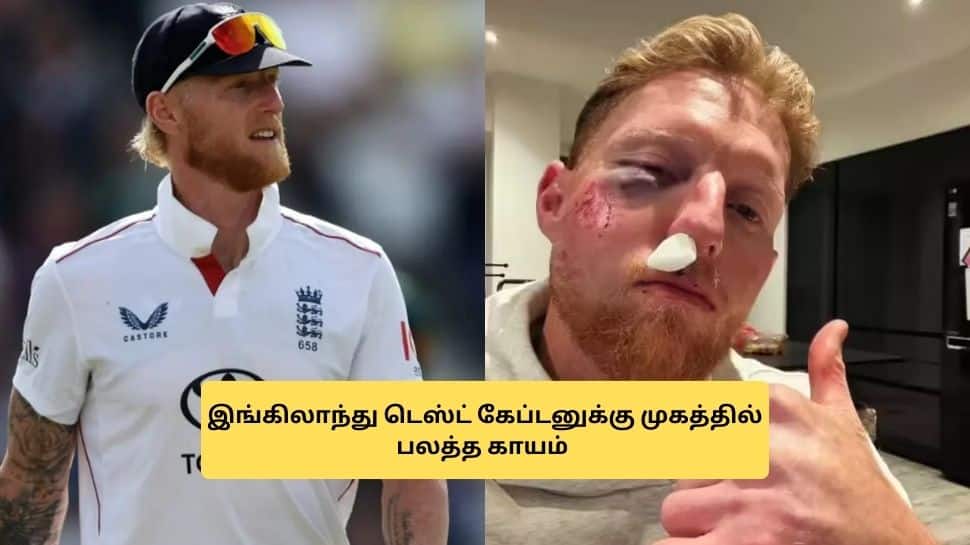 சிதைந்த பென் ஸ்டோக்ஸின் முகம்.. மருத்துவமனியில் சிகிச்சை! என்ன ஆச்சு.. வைரலாகும் போட்டோ