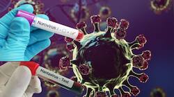 Hantavirus, Norovirus: உலகை மிரட்டும் இரு வைரஸ்கள்... அறிகுறி, சிகிச்சை இதோ