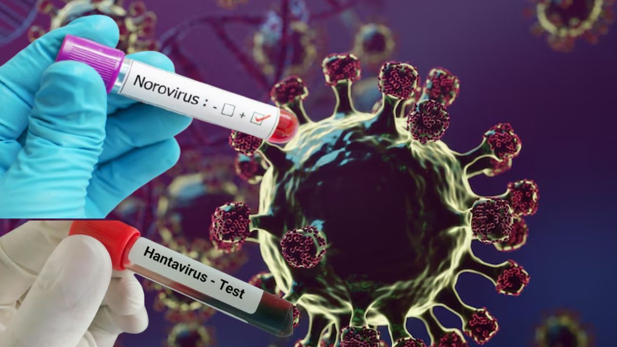 Hantavirus, Norovirus: உலகை மிரட்டும் இரு வைரஸ்கள்... அறிகுறி, சிகிச்சை இதோ Hantavirus, Norovirus: உலகை மிரட்டும் இரு வைரஸ்கள்... அறிகுறி, சிகிச்சை இதோ