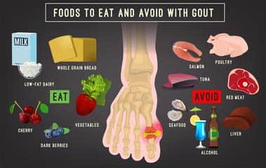 gout health