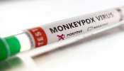 Monkeypox: இந்தியாவில் இதுவரை எங்கெல்லாம் தொற்று உறுதியாகியுள்ளது? பட்டியல் இதோ