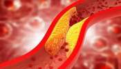 Good Cholesterol: உடலில் நல்ல கொலஸ்ட்ரால் அளவை அதிகரிக்க சூப்பர் வழிகள் 