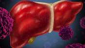 Fatty Liver:கொழுப்பு கல்லீரல் அபாயத்தை அதிகரிக்கும் சில உணவுகள்!
