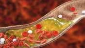 Cholesterol அதிகமானால் இந்த ஆபத்துகளும் அதிகரிக்கும்: ஜாக்கிரதை!!