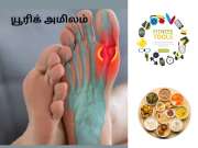 Uric Acid: இரத்தத்தில் யூரிக் அமிலம் அதிகமாகிவிட்டதா? பிரச்சனையை தீர்க்க வழிகள் இவை